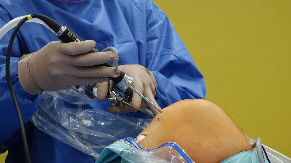 stem cell treatment knee surgery medical