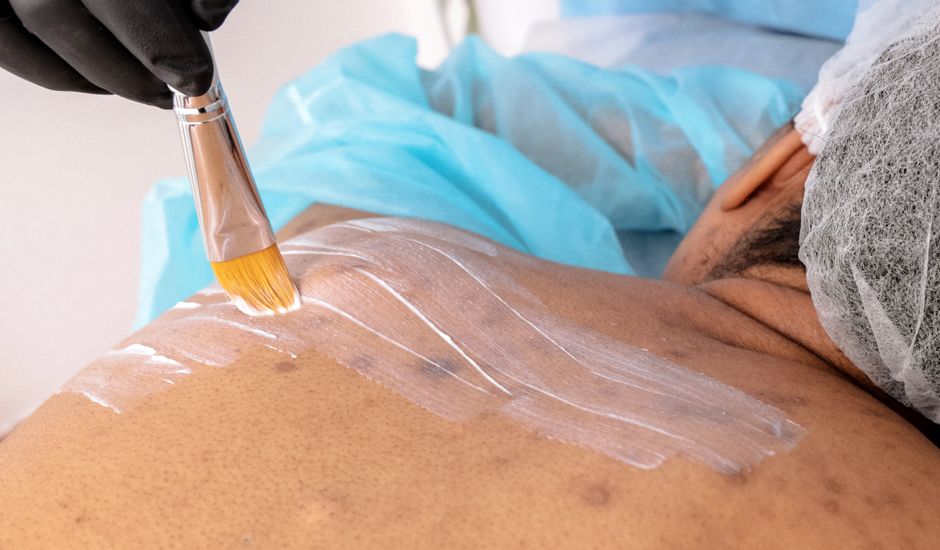 dermatology skin treatment clinic